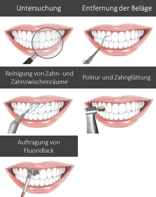 Professionelle Zahnreinigung